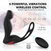 3 in 1 Remote Controlled Vibrating Prostate Massager - Lusty Age